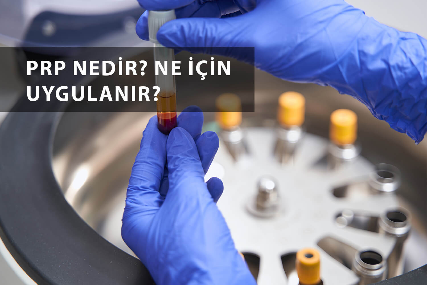 PRP Nedir? Ne İçin Uygulanır? Kapsamlı Rehber